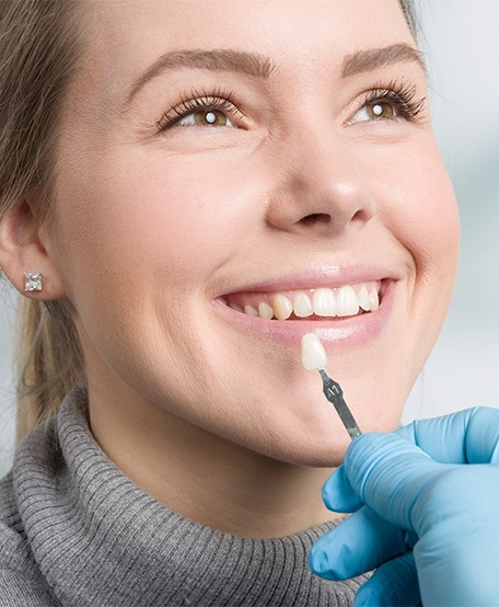 Veneers 2