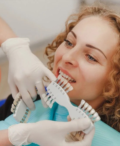 Veneers 7